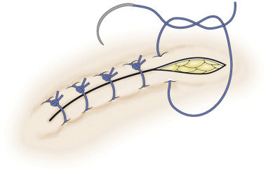 Mixed Sutures Thread with Needle (EXPIRED) Practice Sutures - For practice use (20 for $7.99)